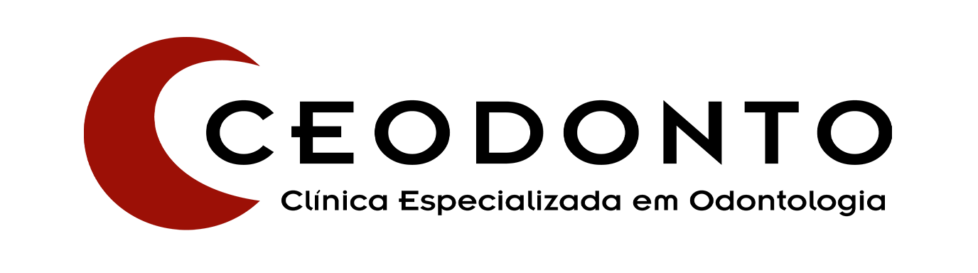 lg3